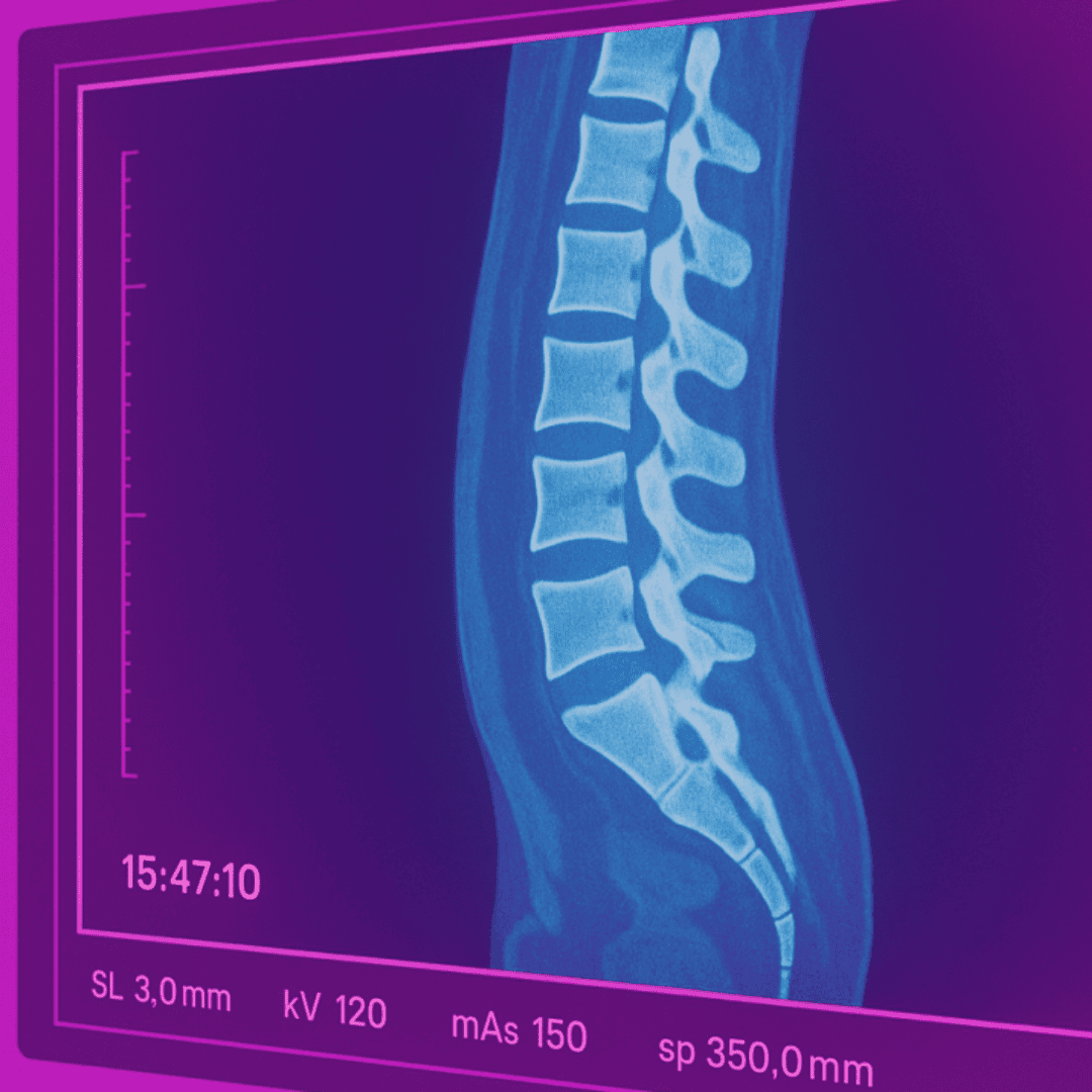 ICH E6(R3) Raises the Bar on Imaging in Clinical Trials—Are You Ready?